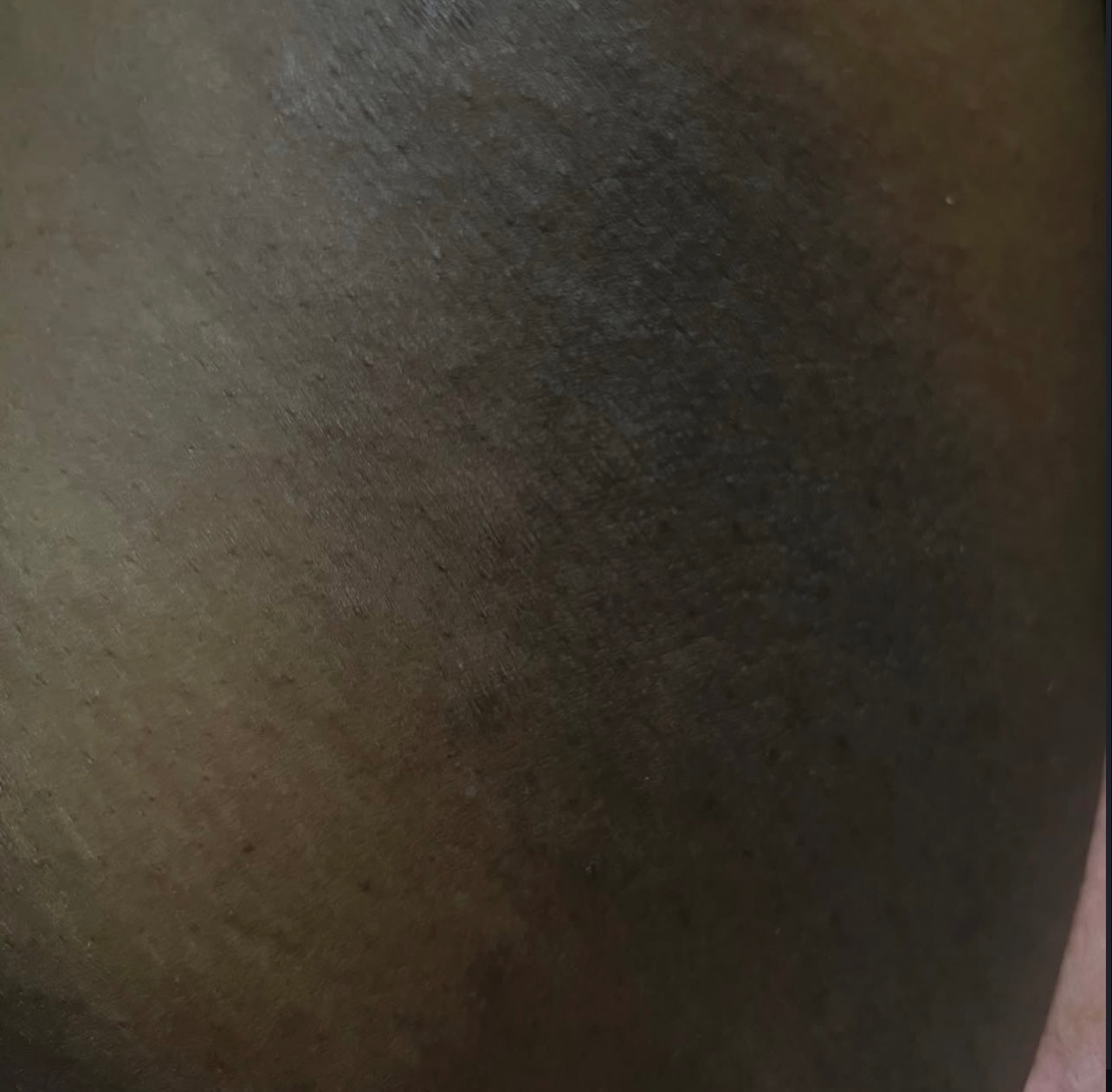 Dark inner thigh Kit (Routine bundle)