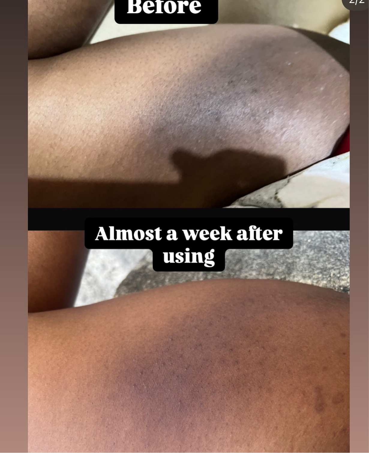 Glow Intimate Cream